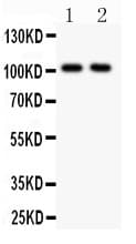 GRIA1 / GLUR1 Antibody (aa19-360)