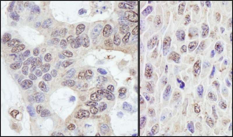 PRKRIR Antibody (aa150-200)