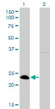 NFYB Antibody (clone 6H6)