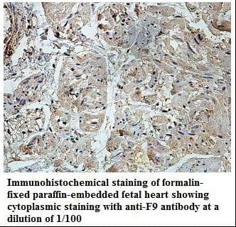 F9 / Factor IX Antibody (aa48-191)