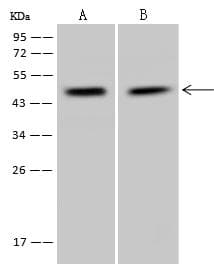 Polyclonal Rabbit anti-Human PPP1R7 Antibody (WB)