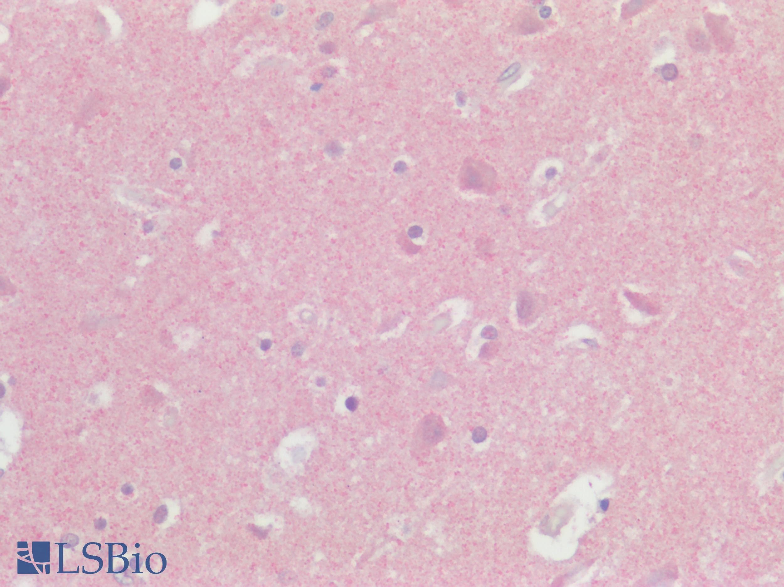 IHC-plus™ Polyclonal Rabbit anti-Human GPR75 Antibody (N-Terminus, IHC)