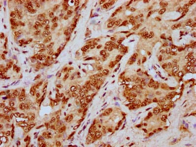HIST1H4I Antibody