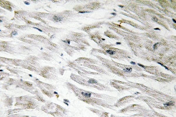 PPP1R14A / CPI-17 Antibody (Lys32)