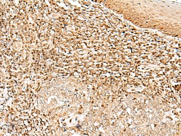 Polyclonal Rabbit anti-Human DNPEP Antibody (IHC)