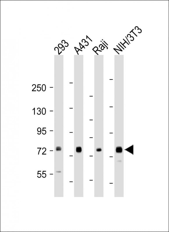 MAP3K7 / TAK1 Antibody (Ser439)