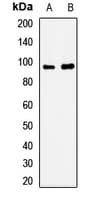 Polyclonal Rabbit anti-Human SORT1 / Sortilin Antibody (IHC, WB)