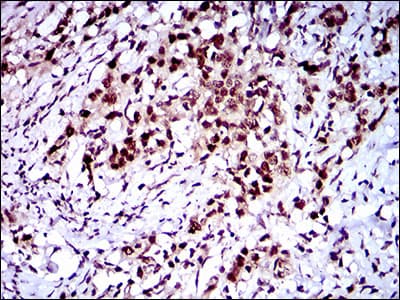 CFLAR / FLIP Antibody (aa100-251, clone 7A3D12)