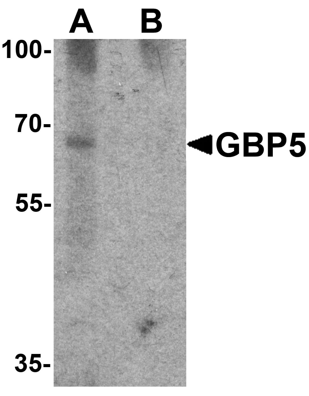 IHC-plus™ GBP5 Antibody