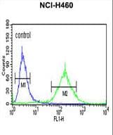 Polyclonal Rabbit anti-Human BBS10 Antibody (aa515-544, WB)