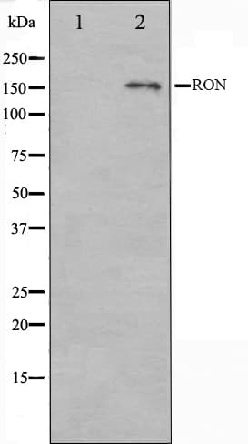 Polyclonal Rabbit anti-Human MST1R / RON Antibody (IF, WB)