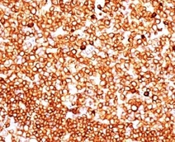 CD79A / CD79 Alpha Antibody (aa202-216, clone SPM549, Azide-free, BSA-free)