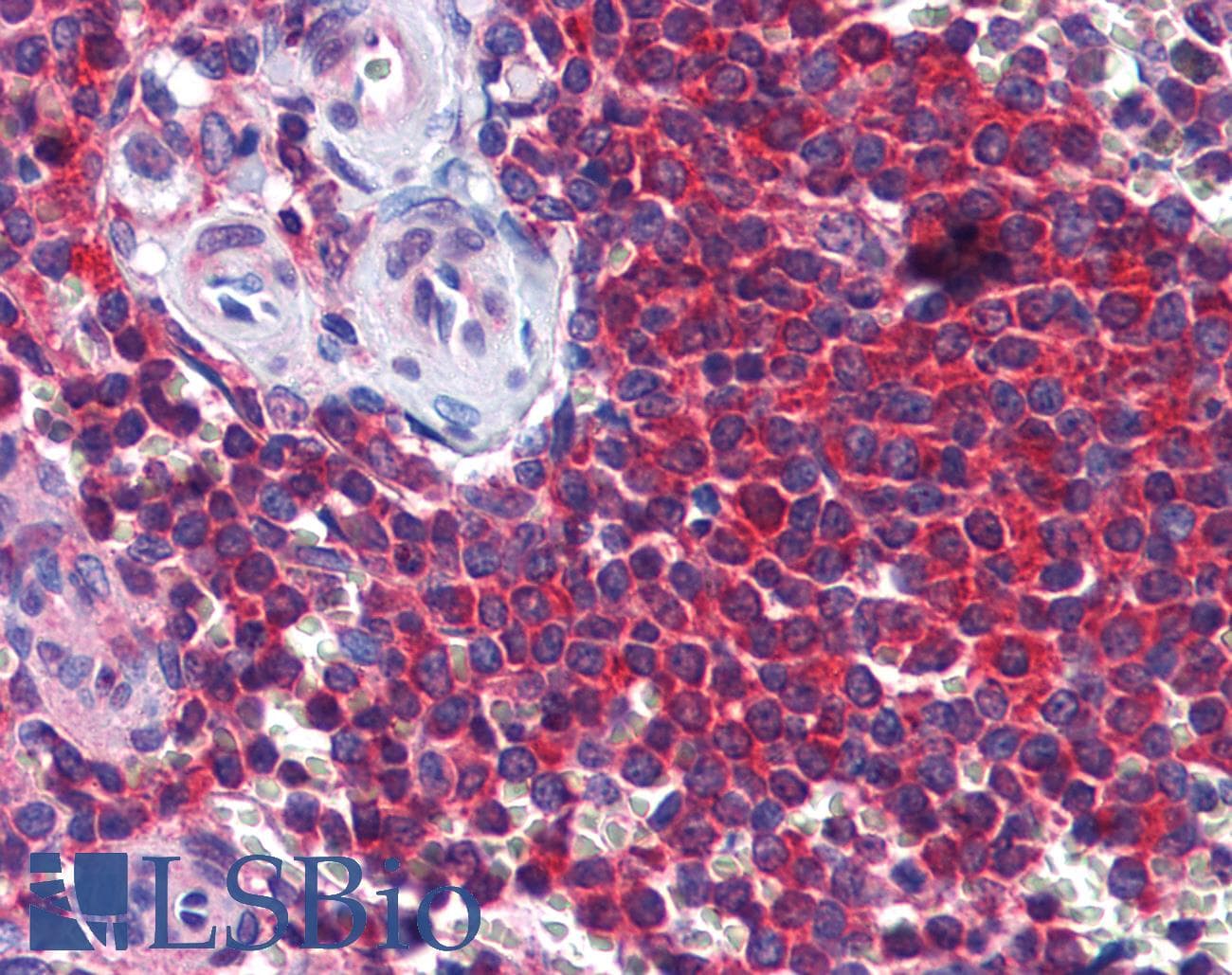 IHC-plus™ Monoclonal Mouse anti-Human STI1 / STIP1 Antibody (clone 1E3, IHC, IF, WB)