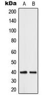 ABHD12B Antibody (C-Terminus)