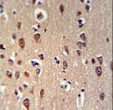 Polyclonal Rabbit anti-Human GRPR Antibody (aa123-152, IHC)