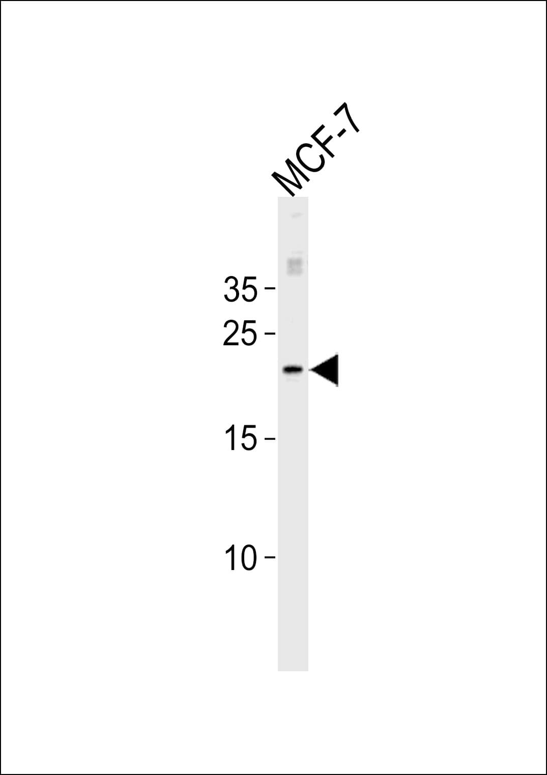 MGMT Antibody (aa1-30)