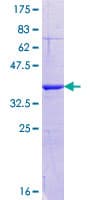 Human MLXIPL / CHREBP Protein (Recombinant GST, N-terminus)