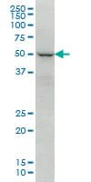 FOXC2 Antibody (clone 2H3)