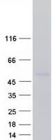 Human MICA Protein (Recombinant Myc-DDK (Flag))