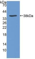 VLDLR Antibody (aa418-722)