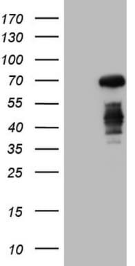 CSF1 / MCSF Antibody (aa223-496, clone OTI1D10)