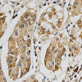 Polyclonal Rabbit anti-Human MAPK10 / JNK3 Antibody (IHC, WB)