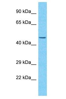 ZNF736 Antibody (aa89-138)