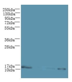 Polyclonal Rabbit anti-Human C2orf15 Antibody (IHC, WB)