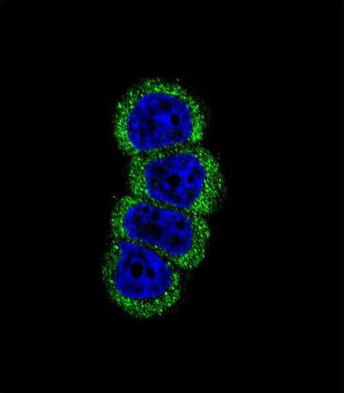 Polyclonal Rabbit anti-Human ERBB2 / HER2 Antibody (IHC, IF, WB)