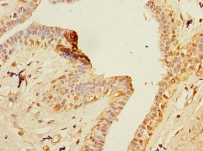 Polyclonal Rabbit anti-Human ZNF670 Antibody (IHC, WB)
