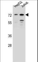 DACH2 Antibody (aa145-173)