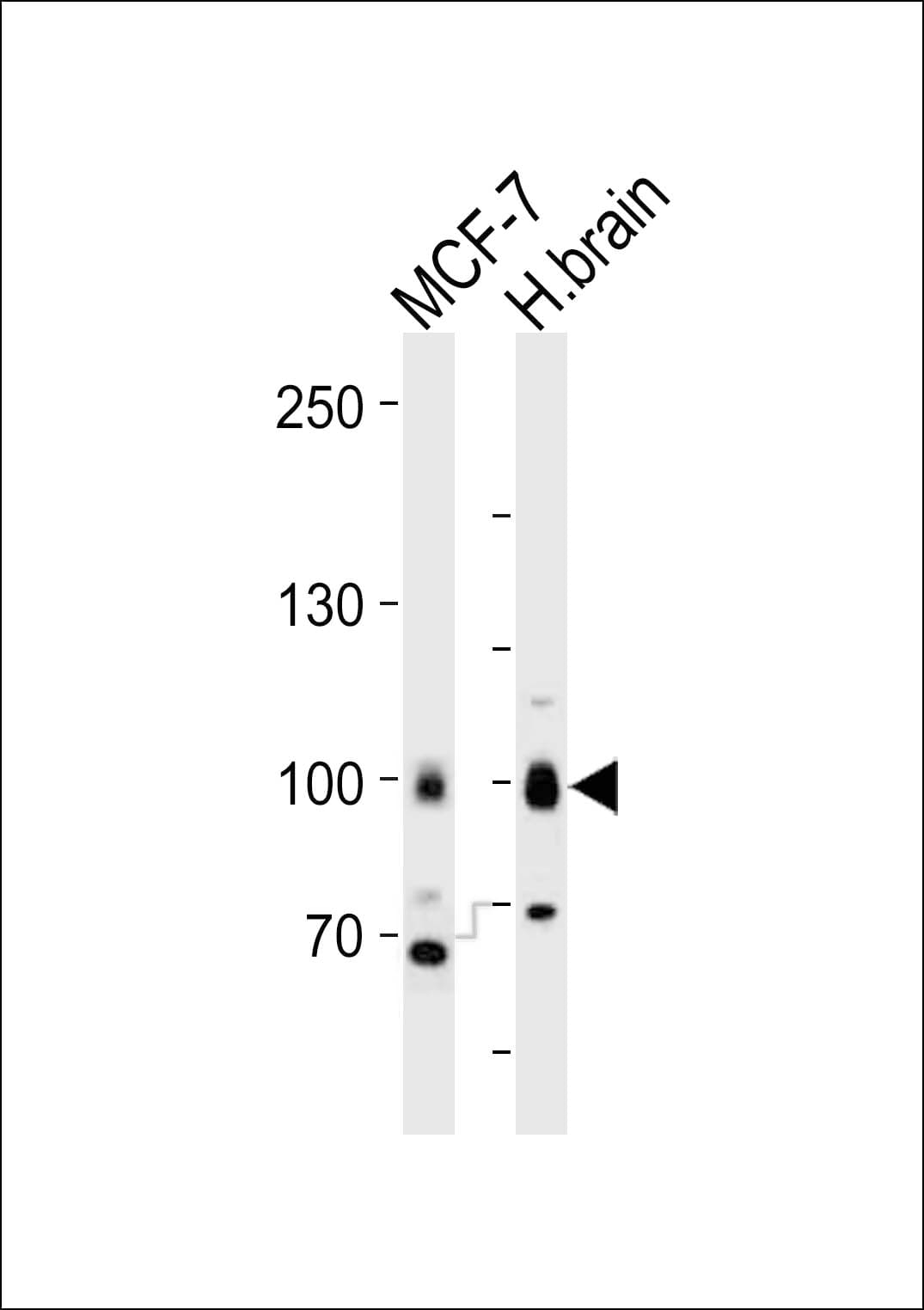 TLE1 / TLE 1 Antibody (aa187-221)