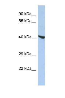 STEAP2 Antibody (aa71-120)