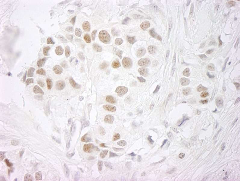 SMEK2 Antibody (aa715-C-term)