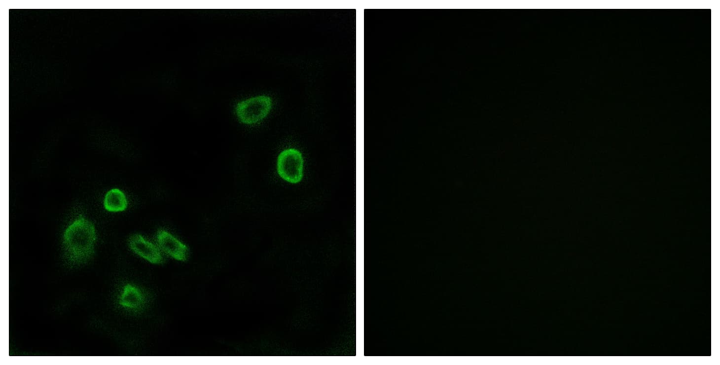 Polyclonal Rabbit anti-Human BRP44L Antibody (aa11-60, IHC, IF, WB)