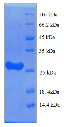 Human C1QTNF3 / CTRP3 Protein (Recombinant His)