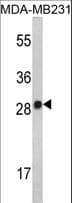 IL2 Antibody (aa50-77)