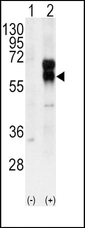 ACVRL1 Antibody (aa38-68)