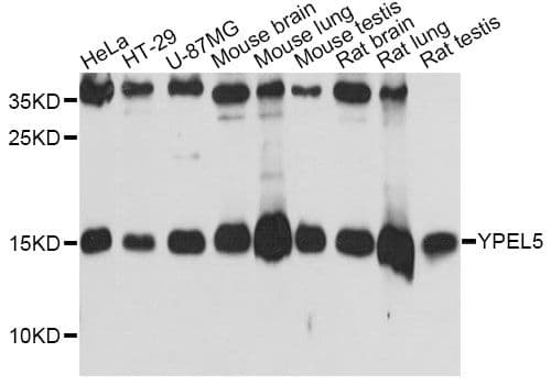 Polyclonal Rabbit anti-Human YPEL5 Antibody (WB)