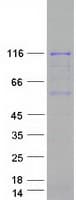 Human PARP1 Protein (Recombinant Myc-DDK (Flag))