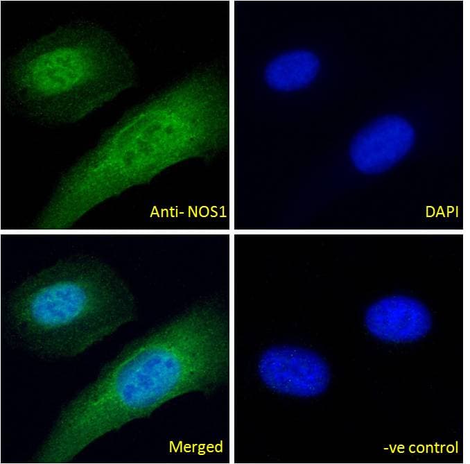 PathPlus™ NOS1 / nNOS Antibody (aa1457-1468)