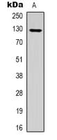 Polyclonal Rabbit anti-Human NRIP1 / RIP140 Antibody (Acetyl-Lys158, WB)