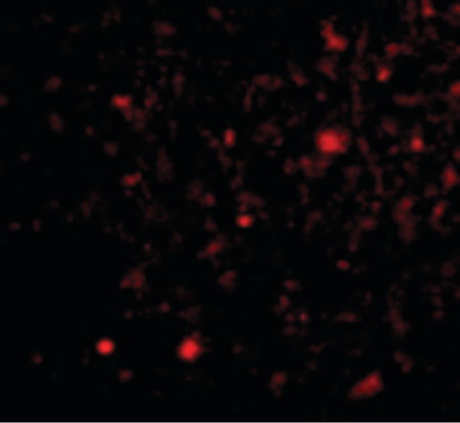 IHC-plus™ Polyclonal Rabbit anti-Human TOCA1 / FNBP1L Antibody (IHC, IF, WB)