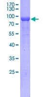 Human CRMP1 Protein (Recombinant GST)