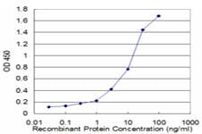 PFN2 / Profilin 2 Antibody (clone 6G3)