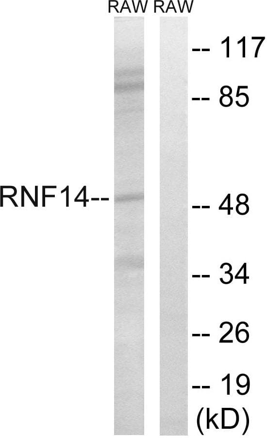 Polyclonal Rabbit anti-Human RNF14 / ARA54 Antibody (WB)