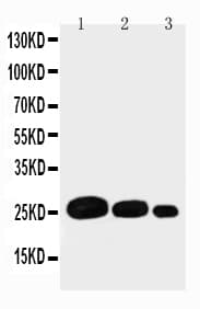 Adiponectin Antibody (aa19-244)