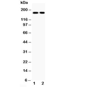 TOP2A / Topoisomerase II Alpha Antibody (aa1466-1480)