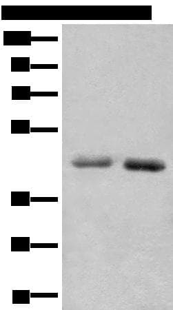 Polyclonal Rabbit anti-Human NADK2 / C5orf33 Antibody (IHC, WB)