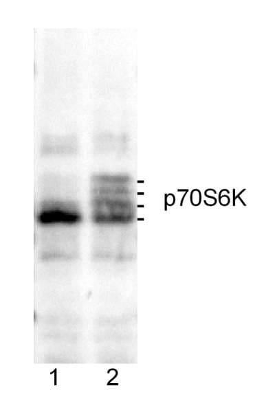RPS6KB1 / P70S6K / S6K Antibody (aa475-C-term)